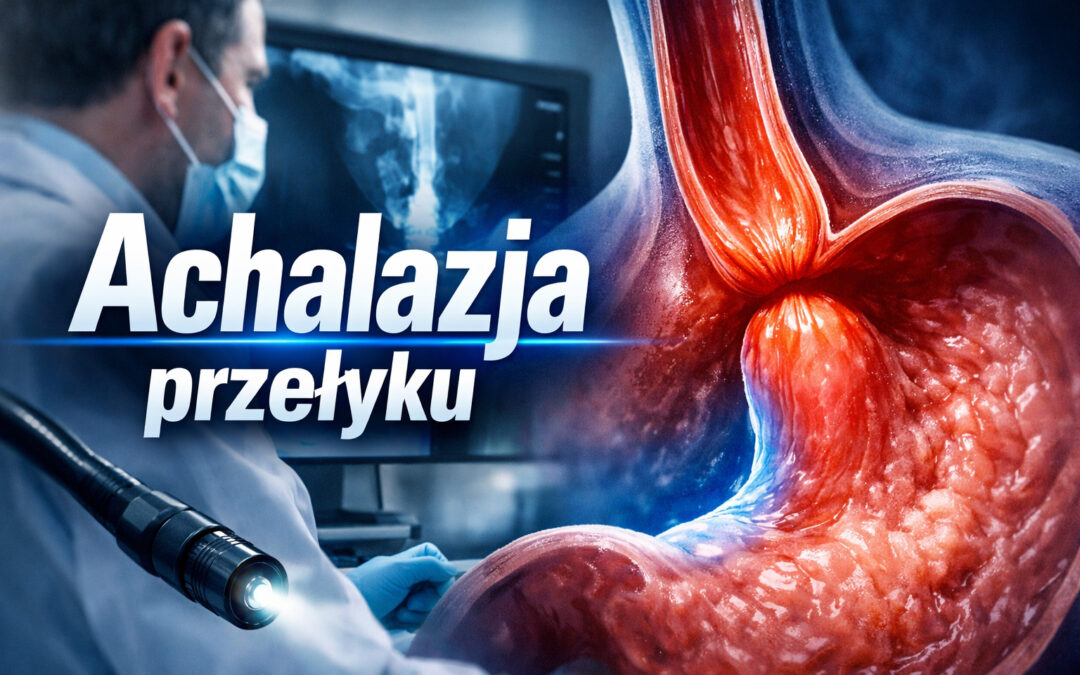 Achalazja przełyku – objawy, diagnostyka i leczenie