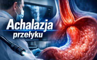 Achalazja przełyku – objawy, diagnostyka i leczenie