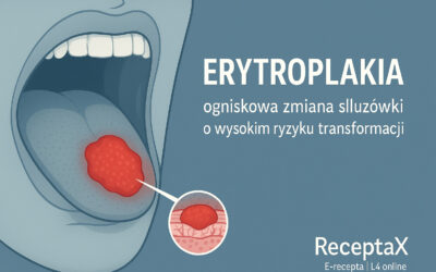 Erytroplakia – objawy i leczenie choroby jamy ustnej