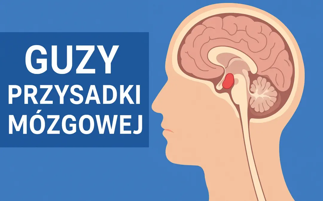 Guzy przysadki mózgowej – objawy, leczenie i rokowanie