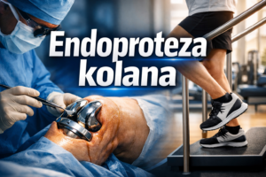 Endoproteza kolana