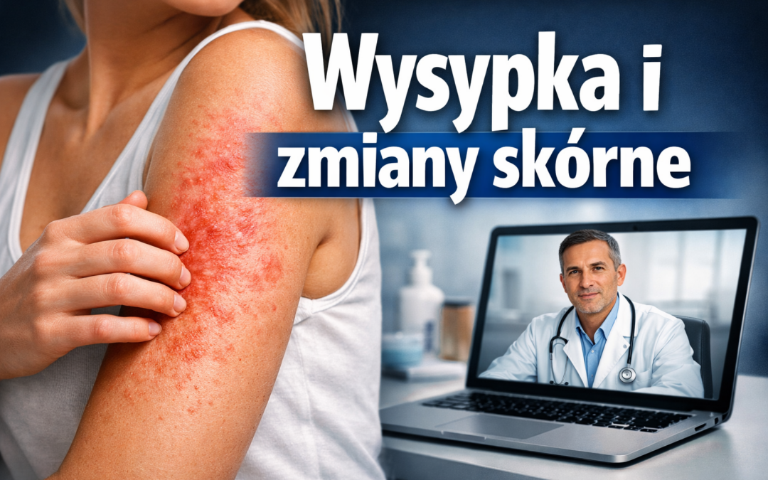 Wysypka i zmiany skórne – czy dermatolog online pomoże?