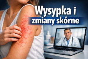 Wysypka i zmiany skórne – czy dermatolog online pomoże?